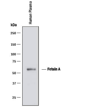 Western blot shows human plasma. PVDF membrane was probed with 1 µg/mL of Mouse Anti-Human Fetuin A/AHSG Monoclonal Antibody (Catalog # MAB1184) followed by HRP-conjugated Anti-Mouse IgG Secondary Antibody (Catalog # HAF018). A specific band was detected for Fetuin A/AHSG at approximately 55 kDa (as indicated). This experiment was conducted under reducing conditions and using Immunoblot Buffer Group 1.