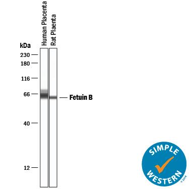 Simple Western lane view shows lysates of human placenta tissue and rat placenta tissue, loaded at 0.2 mg/mL. A specific band was detected for Fetuin B at approximately 64 kDa (as indicated) using 2.5 µg/mL of Goat Anti-Human/Mouse/Rat Fetuin B Antigen Affinity-purified Polyclonal Antibody (Catalog # AF1725) followed by 1:50 dilution of HRP-conjugated Anti-Goat IgG Secondary Antibody (HAF109). This experiment was conducted under reducing conditions and using the 12-230 kDa separation system.