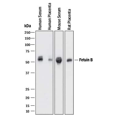 Western blot shows human serum, human placenta tissue lysate, mouse serum, and rat placenta tissue lysate. PVDF membrane was probed with 0.25 µg/mL of Goat Anti-Human/Mouse/Rat Fetuin B Antigen Affinity-purified Polyclonal Antibody (Catalog # AF1725) followed by HRP-conjugated Anti-Goat IgG Secondary Antibody (HAF017). A specific band was detected for Fetuin B at approximately 55 kDa (as indicated). This experiment was conducted under reducing conditions and using Immunoblot Buffer Group 1.