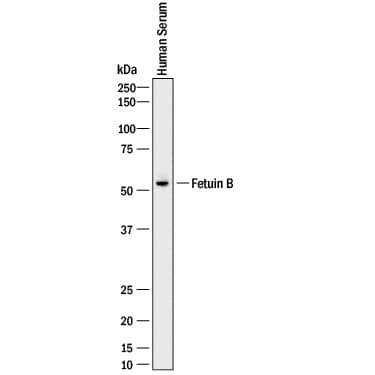 Western blot shows human serum. PVDF membrane was probed with 2 µg/mL of Mouse Anti-Human Fetuin B Monoclonal Antibody (Catalog # MAB1725) followed by HRP-conjugated Anti-Mouse IgG Secondary Antibody (Catalog # HAF018). A specific band was detected for Fetuin B at approximately 55 kDa (as indicated). This experiment was conducted under reducing conditions and using Immunoblot Buffer Group 1.