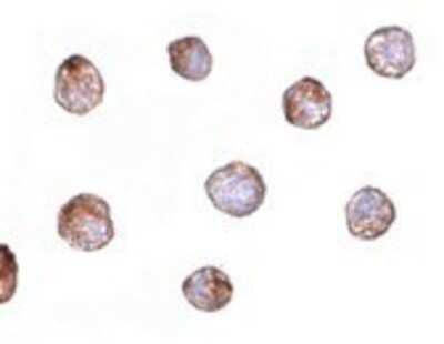 Immunocytochemistry/Immunofluorescence: Fibulin-3/EFEMP1 Antibody [NBP1-77040] - HeLa cells with EFEMP1 antibody at 20 ug/ml.