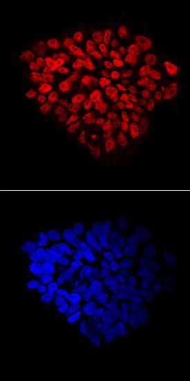 FoxP1 was detected in immersion fixed BG01V human embryonic stem cells using Mouse Anti-Human FoxP1 Monoclonal Antibody (Catalog # MAB45341) at 10 µg/mL for 3 hours at room temperature. Cells were stained using the NorthernLights™ 557-conjugated Anti-Mouse IgG Secondary Antibody (red, upper panel; Catalog # NL007) and counterstained with DAPI (blue, lower panel). Specific staining was localized to nuclei. View our protocol for Fluorescent ICC Staining of Stem Cells on Coverslips.