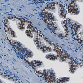 FoxP1 was detected in immersion fixed paraffin-embedded sections of human prostate using Mouse Anti-Human FoxP1 Monoclonal Antibody (Catalog # MAB45341) at 15 µg/mL overnight at 4 °C. Before incubation with the primary antibody, tissue was subjected to heat-induced epitope retrieval using Antigen Retrieval Reagent-Basic (Catalog # CTS013). Tissue was stained using the Anti-Mouse HRP-DAB Cell & Tissue Staining Kit (brown; Catalog # CTS002) and counter-stained with hematoxylin (blue). Specific staining was localized to the nuclei of epithelial cells. View our protocol for Chromogenic IHC Staining of Paraffin-embedded Tissue Sections.