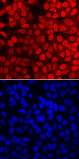 FoxP1 was detected in immersion fixed MCF-7 human breast cancer cell line using Mouse Anti-Human FoxP1 Monoclonal Antibody (Catalog # MAB4534) at 10 µg/mL for 3 hours at room temperature. Cells were stained using the NorthernLights™ 557-conjugated Anti-Mouse IgG Secondary Antibody (red, upper panel; Catalog # NL007) and counterstained with DAPI (blue, lower panel). Specific staining was localized to nuclei. View our protocol for Fluorescent ICC Staining of Cells on Coverslips.