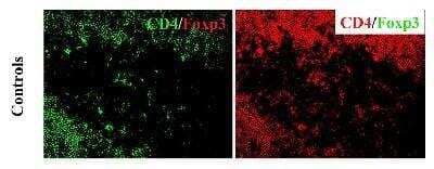 Immunohistochemistry-Frozen: FoxP3 Antibody [NB600-245] - Incubated only with CD4 and no Foxp3