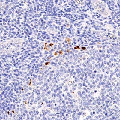 Immunohistochemistry-Paraffin: FoxP3 Antibody [NBP2-24397] - IHC analysis of formalin fixed paraffin-embedded (FFPE) human tonsil using FOXP3 antibody at 1:50 on a Bond Rx autostainer (Leica Biosystems). The assay involved 20 minutes of heat induced antigen retrieval (HIER) using 10mM sodium citrate buffer (pH 6.0) and endogenous peroxidase quenching with peroxide block. The sections were incubated with primary antibody for 30 minutes and Bond Polymer Refine Detection (Leica Biosystems) with DAB was used for signal development followed by counterstaining with hematoxylin. Whole slide scanning and capturing of representative images was performed using Aperio AT2 (Leica Biosystems). Nuclear staining was observed. Staining was performed by Histowiz.