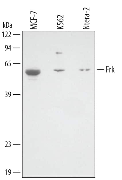 Western blot shows lysates of MCF-7 human breast cancer cell line, K562 human chronic myelogenous leukemia cell line, and NTera-2 human testicular embryonic carcinoma cell line. PVDF membrane was probed with 2 µg/mL of Goat Anti-Human/Mouse/Rat Frk Antigen Affinity-purified Polyclonal Antibody (Catalog # AF3766) followed by HRP-conjugated Anti-Goat IgG Secondary Antibody (Catalog # HAF109). A specific band was detected for Frk at approximately 58 kDa (as indicated). This experiment was conducted under reducing conditions and using Immunoblot Buffer Group 1.