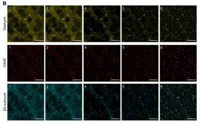 Immunohistochemistry: GABA-A R beta 3 Antibody [NB300-199] - Each channel was filtered frame by frame. The raw data was acquired at high confocal resolution (XY: 234.32 um x 234.32 um, pixel size = 0.114 um) using a 63x glycerol objective (NA=1.3). Z-steps were 0.15 um per frame. Acquired raw data (1) was filtered using an anisotropic diffusion 2D filter (2). (5). The final images (6) were obtained by thresholding the immunosignal. Scale bars: 10um. Image collected and cropped by CiteAb from the following publication (//www.nature.com/articles/ncomms9950) licensed under a CC-BY licence.