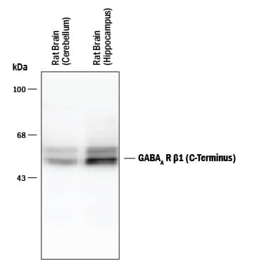 Western blot of 7 μg of rat cerebellar and hippocampal lysates showing specific immunolabeling of the ~55 kDa  beta 1 subunit of the GABAA R.