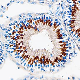 Polypeptide GalNac Transferase 10/GALNT10 was detected in perfusion fixed frozen sections of mouse testis using Sheep Anti-Human/ Mouse Polypeptide GalNac Transferase 10/ GALNT10 Antigen Affinity-purified Polyclonal Antibody (Catalog # AF7575) at 5 µg/mL overnight at 4 °C. Tissue was stained using the Anti-Sheep HRP-DAB Cell & Tissue Staining Kit (brown; Catalog # CTS019) and counterstained with hematoxylin (blue). Specific staining was localized to Golgi organelles in spermatocytes. View our protocol for Chromogenic IHC Staining of Paraffin-embedded Tissue Sections.