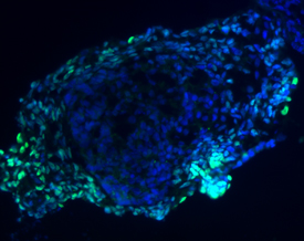 GATA‑4 was detected in immersion fixed differentiated human embryonic stem cells using 10 µg/mL Goat Anti-Human GATA‑4 Antigen Affinity-purified Polyclonal Antibody (Catalog # AF2606) for 3 hours at room temperature. Cells were stained (green) and counterstained with DAPI (blue). View our protocol for Fluorescent ICC Staining of Cells on Coverslips.