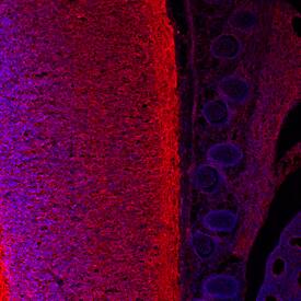 Immunohistochemistry GDF-6/BMP-13 Antibody