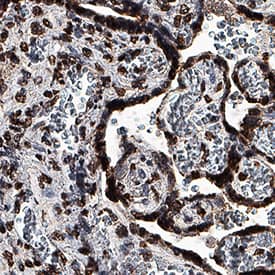   GDF‑15  was detected in immersion fixed paraffin-embedded sections of human placenta  using Mouse Anti-Human GDF‑15 Monoclonal Antibody (Catalog #  MAB9572) at 5 µg/mL for 1 hour at room temperature  followed by incubation with the Anti-Mouse IgG VisUCyte™ HRP  Polymer Antibody (Catalog # VC001).  Before incubation with the primary antibody, tissue was subjected to  heat-induced epitope retrieval using Antigen Retrieval Reagent-Basic (Catalog  # CTS013).  Tissue was stained using DAB (brown) and counterstained with hematoxylin  (blue). Specific staining was localized to syncytiotrophoblasts. View our  protocol for IHC  Staining with VisUCyte HRP Polymer Detection Reagents.
