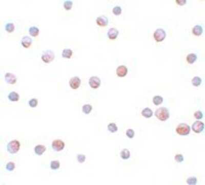 Immunocytochemistry: GEMIN2 Antibody [NBP1-77177] - HeLa cells at 4 ug/mL.