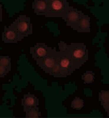 Immunofluorescence: GEMIN2 Antibody [NBP1-77177] - HeLa cells at 20 ug/mL.