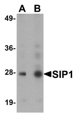 Western Blot: GEMIN2 Antibody [NBP1-77177] - Analysis in HeLa cell lysate with antibody at (A) 0.5 and (B) 1ug/mL.