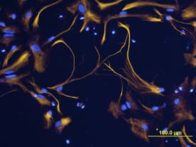 GFAP was detected in immersion fixed differentiated rat cortical stem cells using Sheep Anti-Human GFAP Biotinylated Antigen Affinity-purified Polyclonal Antibody (Catalog # BAF2594) at 10 µg/mL for 3 hours at room temperature. Cells were stained using the NorthernLights™ 557-conjugated Streptavidin (yellow; Catalog # NL999) and counter-stained with DAPI (blue). View our protocol for Fluorescent ICC Staining of Cells on Coverslips.