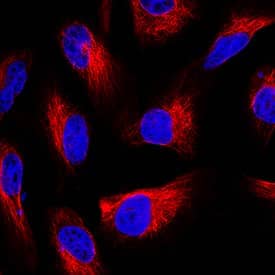 GFAP was detected in immersion fixed U-251MG human glioblastoma cell line using Mouse Anti-Human GFAP Monoclonal Antibody (Catalog # MAB25941) at 1.7 µg/mL for 3 hours at room temperature. Cells were stained using the NorthernLights™ 557-conjugated Anti-Mouse IgG Secondary Antibody (red; Catalog # NL007) and counterstained with DAPI (blue). Specific staining was localized to cytoplasm. View our protocol for Fluorescent ICC Staining of Cells on Coverslips.