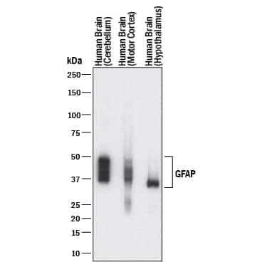 Western blot shows lysates of human brain (cerebellum) tissue, human brain (motor cortex) tissue, and human brain (hypothalamus) tissue. PVDF membrane was probed with 0.25 µg/mL of Mouse Anti-Human GFAP Monoclonal Antibody (Catalog # MAB25941) followed by HRP-conjugated Anti-Mouse IgG Secondary Antibody (Catalog # HAF018). Specific bands were detected for GFAP at approximately 35-50 kDa (as indicated). This experiment was conducted under reducing conditions and using Immunoblot Buffer Group 1.