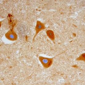 GFRa-1/GDNF Ra-1 was detected in immersion fixed paraffin-embedded sections of human spinal cord using Goat Anti-Human GFRa-1/GDNF Ra-1 Antigen Affinity-purified Polyclonal Antibody (Catalog # AF714) at 15 µg/mL overnight at 4 °C. Tissue was stained using the Anti-Goat HRP-DAB Cell & Tissue Staining Kit (brown; Catalog # CTS008) and counterstained with hematoxylin (blue). Specific staining was localized to ventral horn motoneurons. View our protocol for Chromogenic IHC Staining of Paraffin-embedded Tissue Sections.