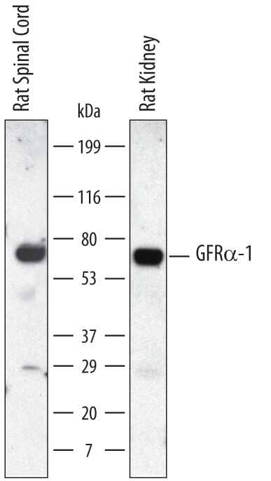 Western blot shows lysates of rat spinal cord tissue and rat kidney tissue. PVDF membrane was probed with 1 µg/mL of Mouse Anti-Rat GFRa-1/GDNF Ra-1 Monoclonal Antibody (Catalog # MAB560) followed by HRP-conjugated Anti-Mouse IgG Secondary Antibody (Catalog # HAF007). A specific band was detected for GFRa-1/GDNF Ra-1 at approximately 60 kDa (as indicated). This experiment was conducted under non-reducing conditions (recommended) and using Immunoblot Buffer Group 1.