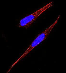 GFRa-2/GDNF Ra-2 was detected in immersion fixed SH-SY5Y human neuroblastoma cell line using Mouse Anti-Human GFRa-2/ GDNF Ra-2 Monoclonal Antibody (Catalog # MAB6131) at 8 µg/mL for 3 hours at room temperature. Cells were stained using the NorthernLights™ 557-conjugated Anti-Mouse IgG Secondary Antibody (red; Catalog # NL007) and counterstained with DAPI (blue). Specific staining was localized to cell membranes. View our protocol for Fluorescent ICC Staining of Cells on Coverslips.