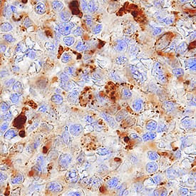 GILT/IFI30 was detected in immersion fixed paraffin-embedded sections of human spleen using Sheep Anti-Human GILT/IFI30 Antigen Affinity-purified Polyclonal Antibody (Catalog # AF7715) at 1 µg/mL overnight at 4 °C. Tissue was stained using the Anti-Sheep HRP-DAB Cell & Tissue Staining Kit (brown; Catalog # CTS019) and counterstained with hematoxylin (blue). Specific staining was localized to lysosomes in cytoplasm. View our protocol for Chromogenic IHC Staining of Paraffin-embedded Tissue Sections.