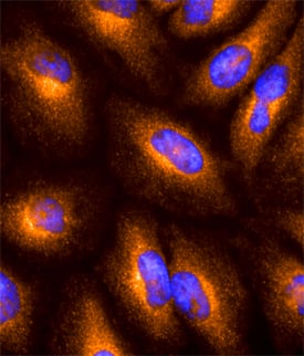 GILT/IFI30 was detected in immersion fixed MCF-7 human breast cancer cell line using Mouse Anti-Human GILT/IFI30 Monoclonal Antibody (Catalog # MAB7715) at 10 µg/mL for 3 hours at room temperature. Cells were stained using the NorthernLights™ 557-conjugated Anti-Mouse IgG Secondary Antibody (red; Catalog # NL007) and counterstained with DAPI (blue). Specific staining was localized to cytoplasm. View our protocol for Fluorescent ICC Staining of Cells on Coverslips.