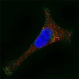 a-Galactosidase A/GLA was detected in immersion fixed HeLa human cervical epithelial carcinoma cell line using Sheep Anti-Human a-Galactosidase A/GLA Antigen Affinity-purified Polyclonal Antibody (Catalog # AF6146) at 15 µg/mL for 3 hours at room temperature. Cells were stained using the Northern-Lights™ 557-conjugated Anti-Sheep IgG Secondary Antibody (red; Catalog # NL010). LAMP1 was also detected using Mouse Anti-Human LAMP1 Mono-clonal Antibody (Catalog # MAB4800). Cells were stained using the Northern-Lights™ 493-conjugated Anti-Mouse IgG Secondary Antibody (green; Catalog # NL009). Cells were counterstained with DAPI (blue). Specific staining was localized to lysosomes. View our protocol for Fluorescent ICC Staining of Cells on Coverslips.