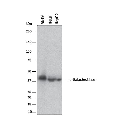 Western blot shows lysates of A549 human lung carcinoma cell line, HeLa human cervical epithelial carcinoma cell line, and HepG2 human hepatocellular carcinoma cell line. PVDF membrane was probed with 2 µg/mL of Sheep Anti-Human a-Galactosidase A/GLA Antigen Affinity-purified Polyclonal Antibody (Catalog # AF6146) followed by HRP-conjugated Anti-Sheep IgG Secondary Antibody (Catalog # HAF016). A specific band was detected for a-Galactosidase A/GLA at approximately 38 kDa (as indicated). This experiment was conducted under reducing conditions and using Immunoblot Buffer Group 1.