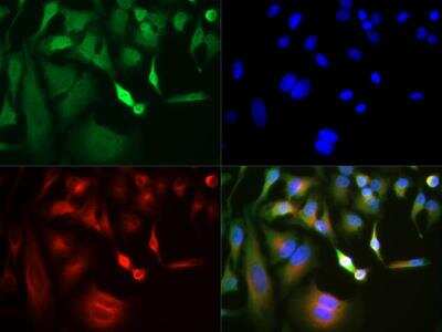 Immunocytochemistry/Immunofluorescence: GLI-3 Antibody [NBP2-29627] - HeLa cells with FITC (green). Nuclei and alpha-tubulin were counterstained with DAPI (blue) and DyLight 550 (red).