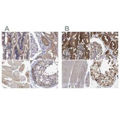 GLOD4 Antibody (NBP1-88464): Novus Biologicals