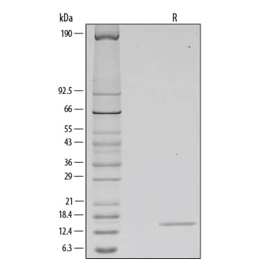 1 μg/lane of Recombinant Human GM-CSF was resolved with SDS-PAGE under reducing (R) conditions and visualized by silver staining, showing a single band at 14 kDa.