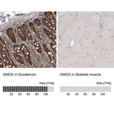 Immunohistochemistry-Paraffin: GMDS Antibody [NBP1-83357] - Staining in human duodenum and skeletal muscle tissues using anti-GMDS antibody. Corresponding GMDS RNA-seq data are presented for the same tissues.