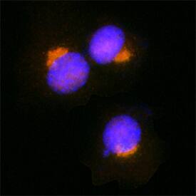 GOLGB1/Giantin was detected in 2% paraformaldehyde immersion fixed HeLa human cervical epithelial carcinoma cell line using Sheep Anti-Human/Rat GOLGB1/Giantin Antigen Affinity-purified Polyclonal Antibody (Catalog # AF8159) at 1.7 µg/mL for 3 hours at room temperature. Cells were stained using the NorthernLights™ 557-conjugated Anti-Sheep IgG Secondary Antibody (red; Catalog # NL010) and counterstained with DAPI (blue). Specific staining was localized to Golgi apparatus vesicles. View our protocol for Fluorescent ICC Staining of Cells on Coverslips.