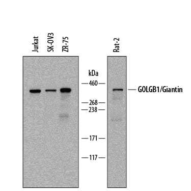 Western blot shows lysates of Jurkat human acute T cell leukemia cell line, SK-OV-3 human ovarian adenocarcinoma cell line, ZR-75 human breast cancer cell line, and Rat-2 rat embryonic fibroblast cell line. PVDF membrane was probed with 1 µg/mL of Sheep Anti-Human/Rat GOLGB1/Giantin Antigen Affinity-purified Polyclonal Antibody (Catalog # AF8159) followed by HRP-conjugated Anti-Sheep IgG Secondary Antibody (Catalog # HAF016). A specific band was detected for GOLGB1/Giantin at approximately 370 kDa (as indicated). This experiment was conducted under reducing conditions and using Immunoblot Buffer Group 1.