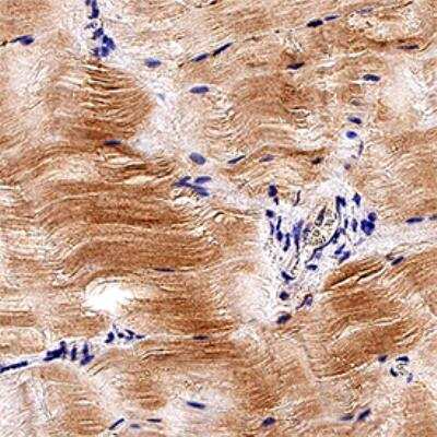 Hmgb1 Hmg 1 Antibody Nb100 2322 Novus Biologicals