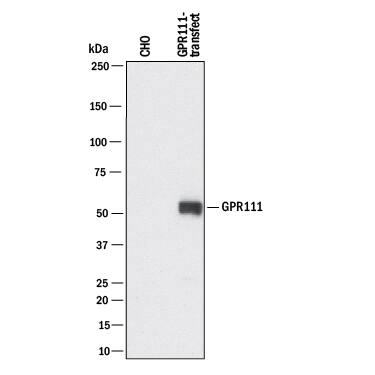 Western Blot GPR111 Antibody (594522) [Unconjugated]