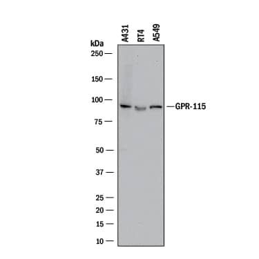 Western Blot GPR115 Antibody (527018) [Unconjugated]