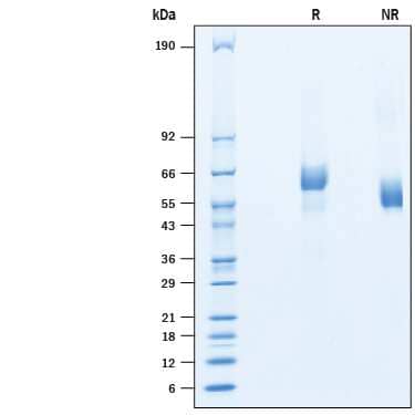 2 μg/lane of Recombinant Human GPR158 His-tag Protein (Catalog # 10286-GP) was  resolved with SDS-PAGE under reducing (R) and non-reducing (NR)  conditions and visualized by Coomassie® Blue staining, showing bands at 50-70 kDa.