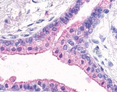 Gpr164 Antibody (nls1851): Novus Biologicals