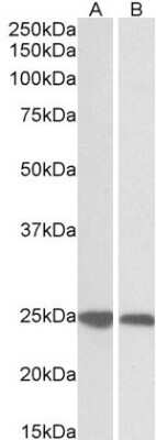 Western Blot: GRB2 Antibody [NB100-866] - (0.03ug/ml) staining of Human (A) and Pig (B) Spleen lysates (35ug protein in RIPA buffer). Primary incubation was 1 hour. Detected by chemiluminescence.