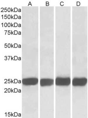 Western Blot: GRB2 Antibody [NB100-866] - (0.05ug/ml) staining  of Mouse (A+C) and Rat (B+D) Brain (A+B) and Spleen (C+D) lysates (35ug total protein in RIPA buffer). Primary incubated for 1 hour. Detected by western blot using chemiluminescence.