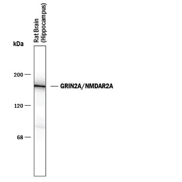 Western Blot NMDA R, NR2A Subunit Antibody [Unconjugated]