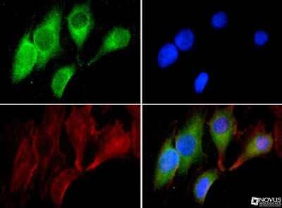 Immunocytochemistry/Immunofluorescence: GRP78/HSPA5 Antibody [NBP1-06277] - BIP/Grp78 antibody was tested in HeLa cells with DyLight 488 (green). Nuclei and alpha-tubulin were counterstained with DAPI (blue) and DyLight 550 (red).
