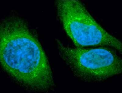 Immunocytochemistry/Immunofluorescence: GRP78/HSPA5 Antibody [NBP1-54318] - Tissue: Heat Shocked HeLa Cells. Species: Human. Fixation: 2% Formaldehyde for 20 min at RT. Primary Antibody: Rabbit Anti-GRP78 (Bip) Polyclonal Antibody at 1:100 for 12 hours at 4C. Secondary Antibody: FITC Goat Anti-Rabbit (green) at 1:200 for 2 hours at RT. Counterstain: DAPI (blue) nuclear stain at 1:40000 for 2 hours at RT. Localization: Endoplasmic reticulum lumen. Melanosome. Cytoplasm. Nucleus. Magnification: 100x. Heat Shocked at 42C for 1h.