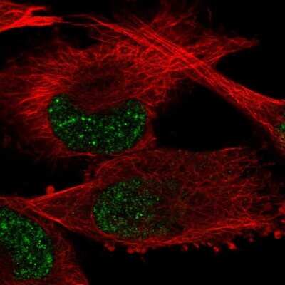 Immunocytochemistry/Immunofluorescence: GTF2H2 Antibody [NBP2-56841] - Staining of human cell line U-251 MG shows localization to nuclear speckles. Antibody staining is shown in green.