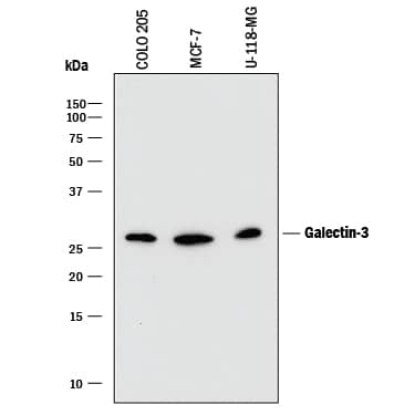 Western blot shows lysates of COLO 205 human colorectal adenocarcinoma cell line, MCF‑7 human breast cancer cell line, and U‑118‑MG human glioblastoma/astrocytoma cell line. PVDF membrane was probed with 0.2 µg/mL of Mouse Anti-Human Galectin‑3 Monoclonal Antibody (Catalog # MAB11542) followed by HRP-conjugated Anti-Mouse IgG Secondary Antibody (Catalog # HAF018). A specific band was detected for Galectin‑3 at approximately 28 kDa (as indicated). This experiment was conducted under reducing conditions and using Immunoblot Buffer Group 1.