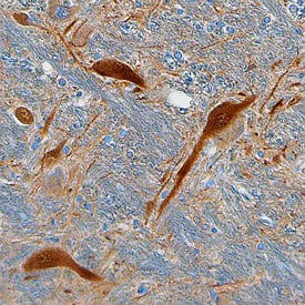 Gephyrin/GPHN was detected in immersion fixed paraffin-embedded sections of human brain (medulla) using Sheep Anti-Human Gephyrin/GPHN Antigen Affinity-purified Polyclonal Antibody (Catalog # AF7519) at 1.7 µg/mL overnight at 4 °C. Tissue was stained using the Anti-Sheep HRP-DAB Cell & Tissue Staining Kit (brown; Catalog # CTS019) and counterstained with hematoxylin (blue). Specific staining was localized to the cytoplasm of neurons. View our protocol for Chromogenic IHC Staining of Paraffin-embedded Tissue Sections.