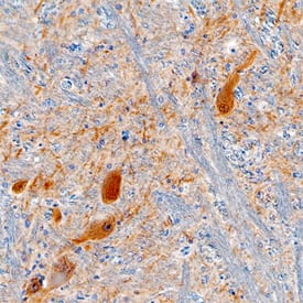 Gephyrin/GPHN was detected in immersion fixed paraffin-embedded sections of human brain (medulla) using Mouse Anti-Human/Mouse Gephyrin/GPHN Monoclonal Antibody (Catalog # MAB7519) at 15 µg/mL overnight at 4 °C. Tissue was stained using the Anti-Mouse HRP-DAB Cell & Tissue Staining Kit (brown; Catalog # CTS002) and counterstained with hematoxylin (blue). Specific staining was localized to neuronal cell bodies. View our protocol for Chromogenic IHC Staining of Paraffin-embedded Tissue Sections.